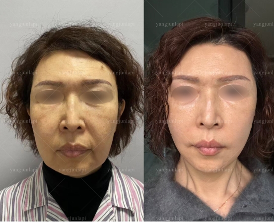 北京四季青橙医生怎么选？杨俊、张利民、杨喆适配人群汇总