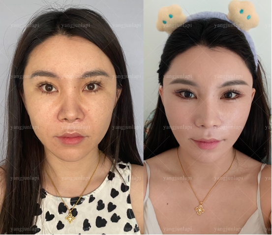 北京做拉皮哪家机构靠谱？四季青橙正规医美实力核验