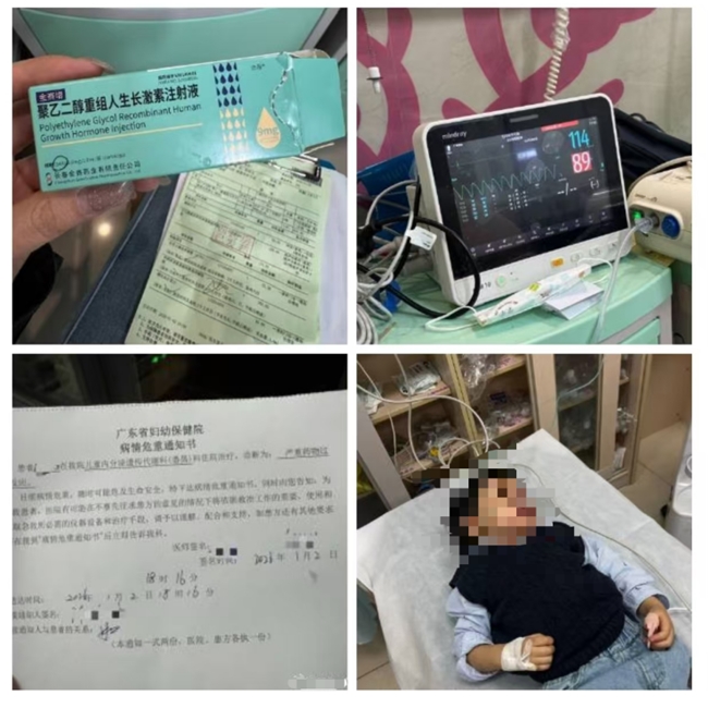 生长激素过敏副作用科普:轻重症辨别、急救方法与安全选药指南