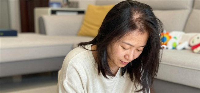 产后妈妈的脱发焦虑，别让气血大亏拖垮你的头发
